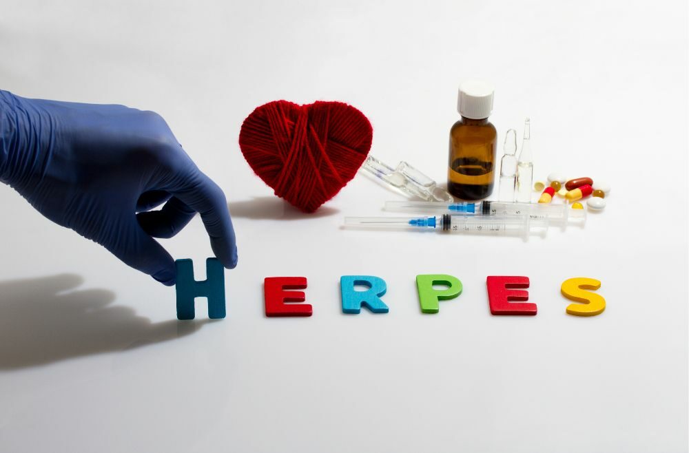Herpes written on table with colored letters