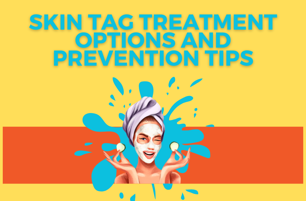 Skin Tag Treatment Options and Prevention Tips
