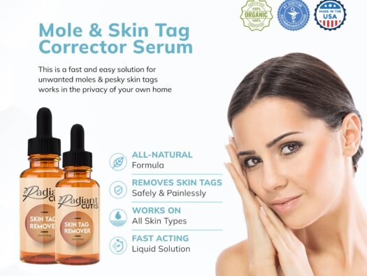 Mole and skin tag removal with Radiant Cutis
